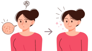 シルファームXは毛穴に効果ある？鼻毛穴・いちご鼻への向き不向きや回数目安を解説！